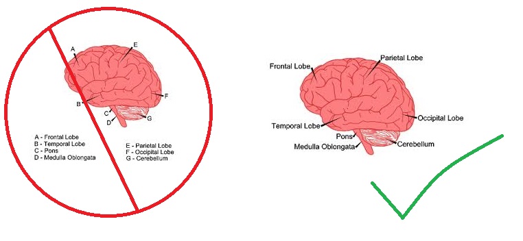 Picture showing a brain with labels